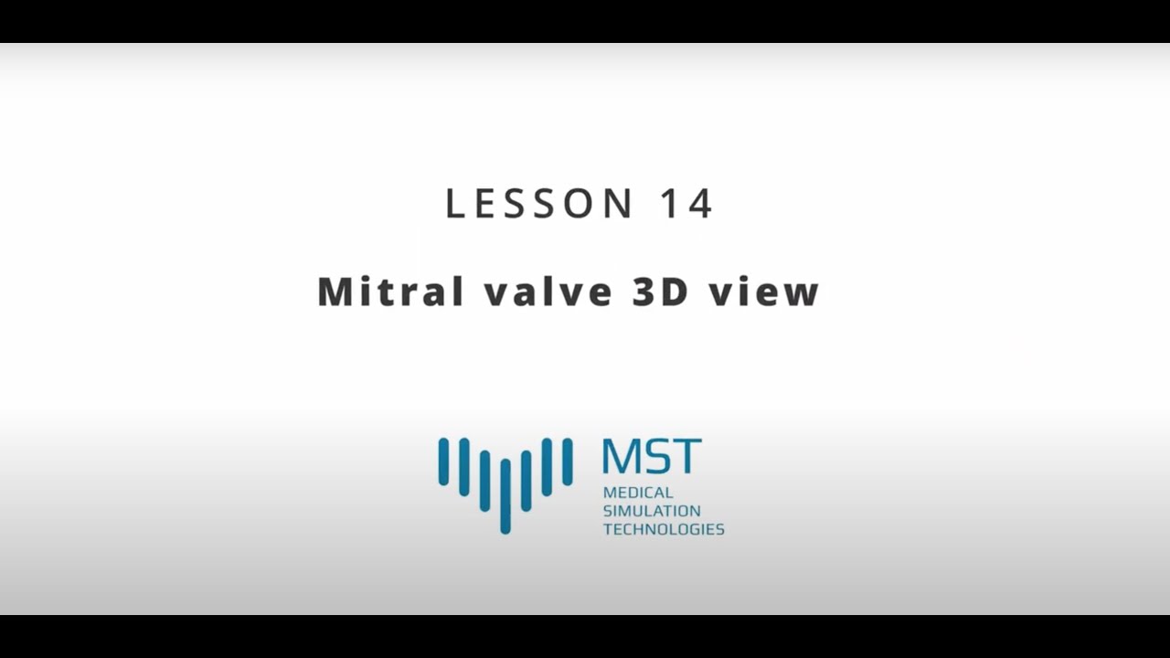 MST Masterclass - Lesson 14 - Mitral valve 3D view