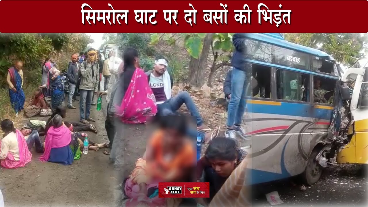 Indore News: सिमरोल घाट पर दो बसों की भिड़ंत, 30 घायल, 8 की हालत गंभीर