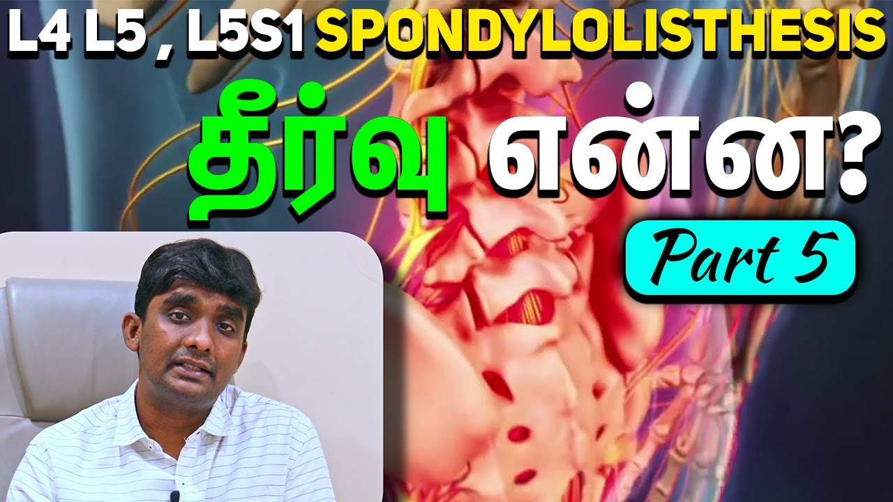 L4 L5 , L5S1 Spondylolisthesis தீர்வு என்ன? Part 5 Dr. Vijayaraghavan | Spine Health Solutions Tamil