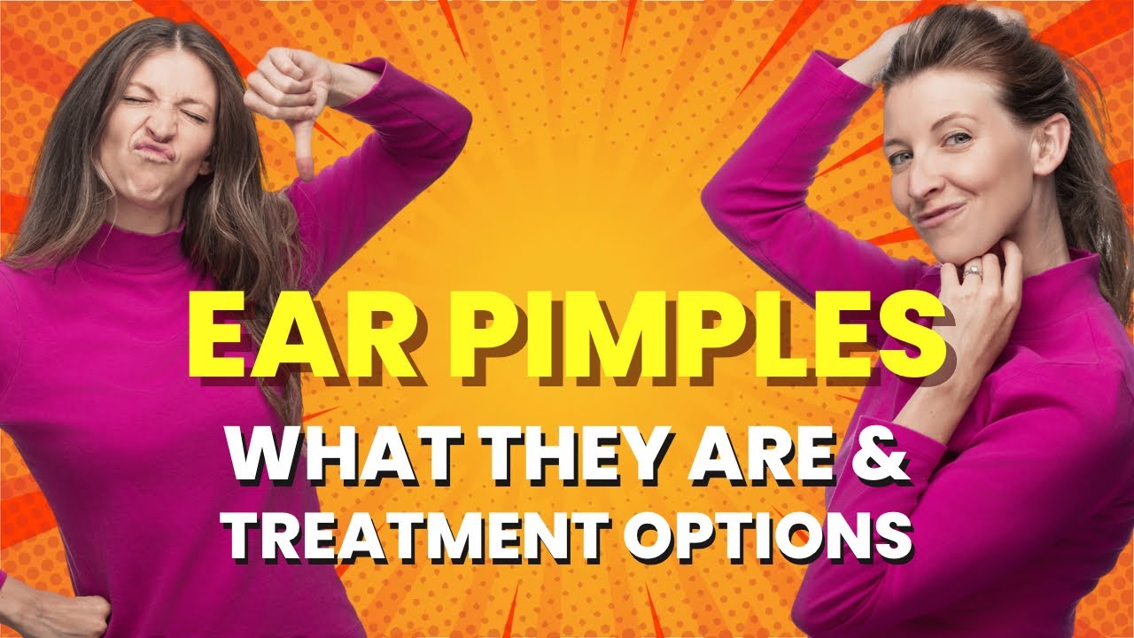 Ear Pimples: What They Are, How to Treat, and Prevent Them!