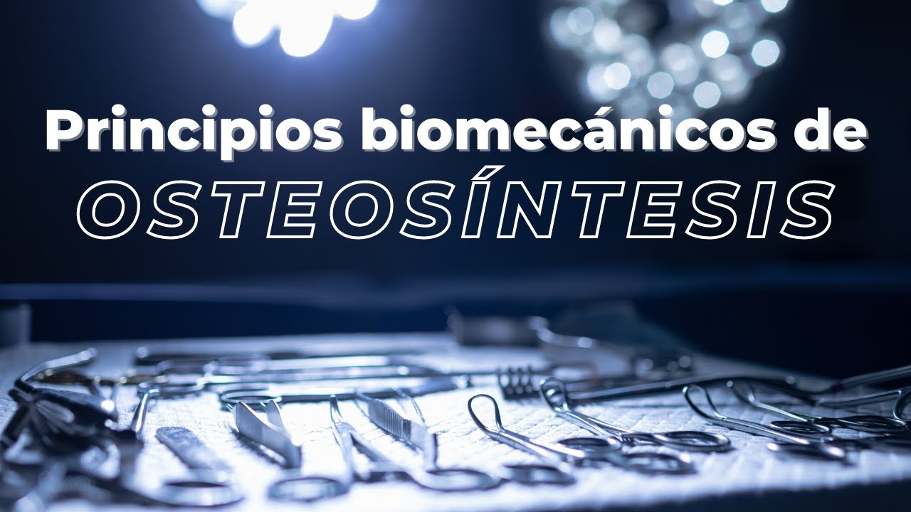 Principios biomecánicos en osteosíntesis