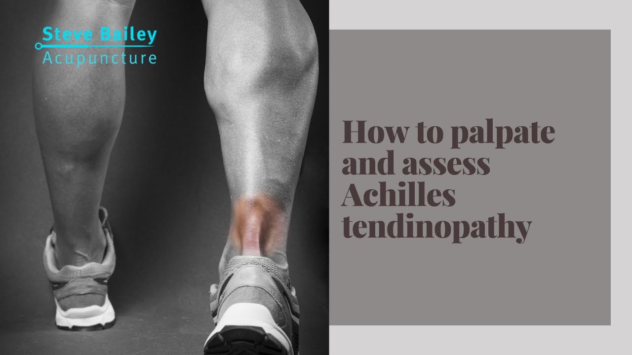 How to palpate and assess achilles tendinopathy