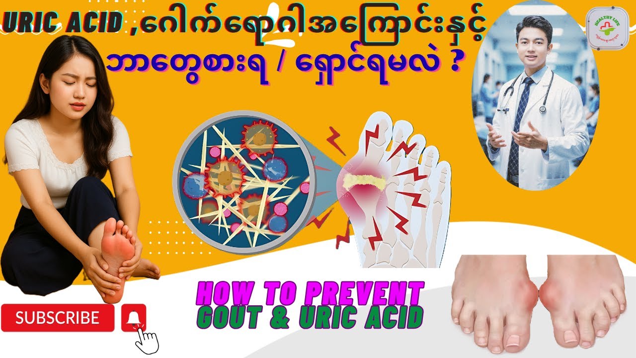 Uric Acidအကြောင်း ဂေါက်ရောဂါအကြောင်းနှင့် စားရ ရှောင်ရမယ့် အစားအစာများ | Foods for Gouty Arthritis