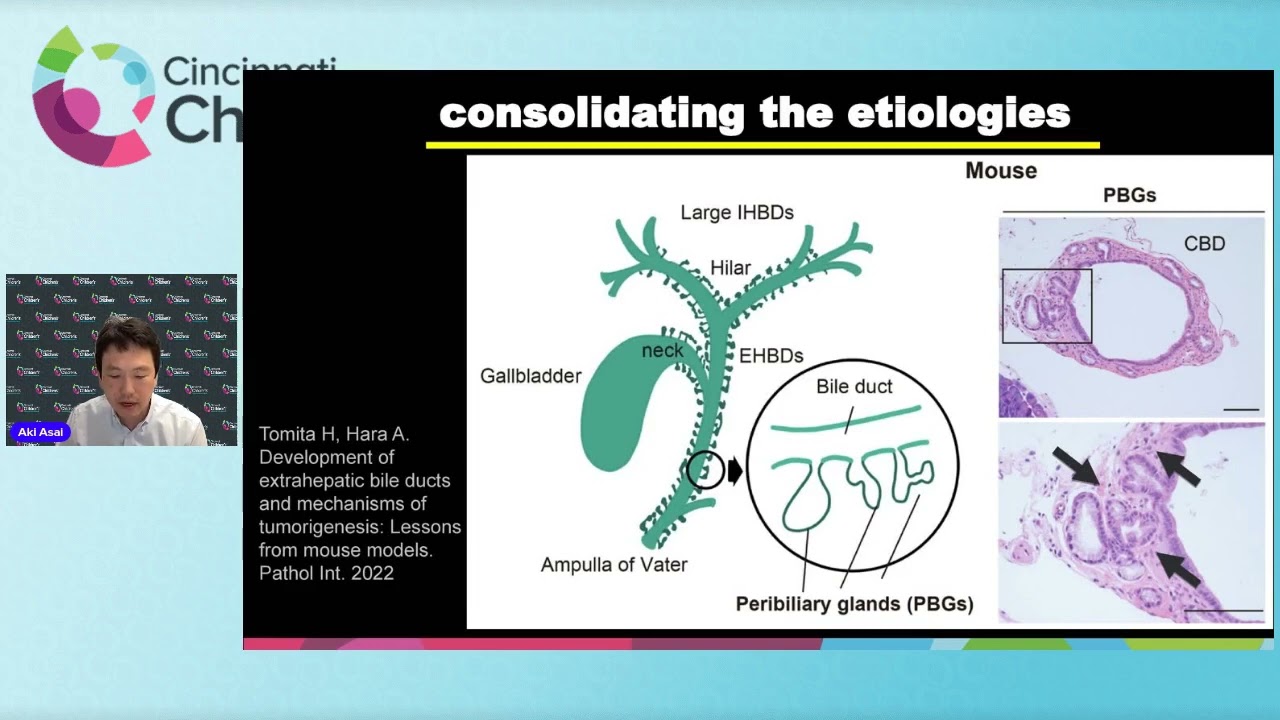 Biliary atresia update