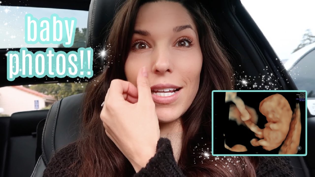 ULTRASOUND AT 9 WEEKS PREGNANT | DOCTORS APPOINTMENT UPDATE & BABY PHOTO REVEAL!!