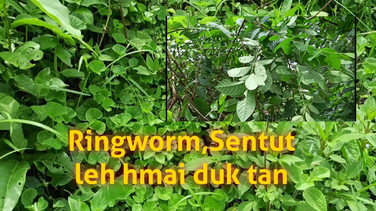 Sentut,Ringworm tan a damdawi tha || Ramhmul damdawi