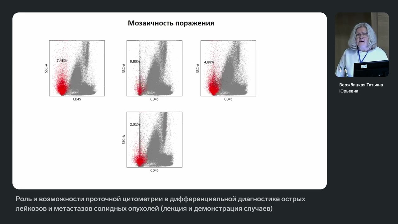 Роль и возможности проточной цитометрии в дифференциальной диагностике острых лейкозов и метастазов