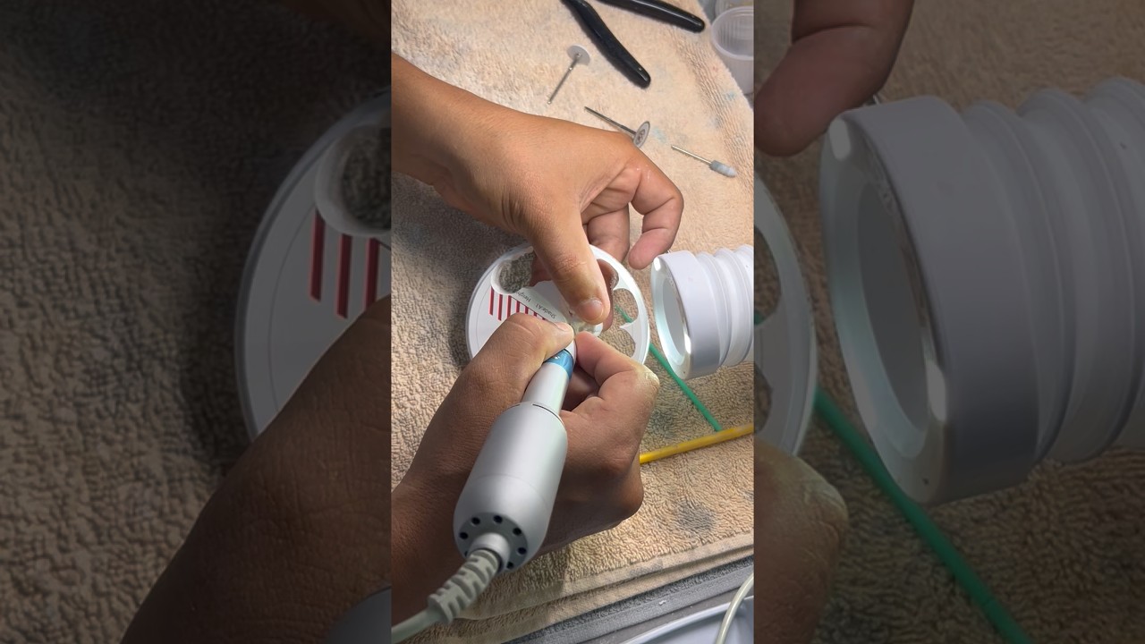 Dois Dentes sobre Implante removidos do disco de Zircônia.