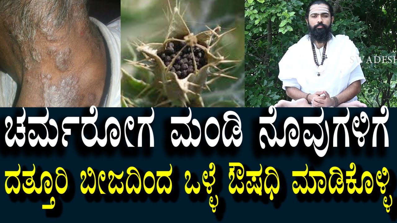 ಚರ್ಮರೋಗ ಮಂಡಿ ನೋವುಗಳಿಗೆ ದತ್ತೂರಿ ಬೀಜದಲ್ಲಿದೆ ಔಷಧಿ Skin disease & Knee Pain Herbal Remedy | Datturi Seed