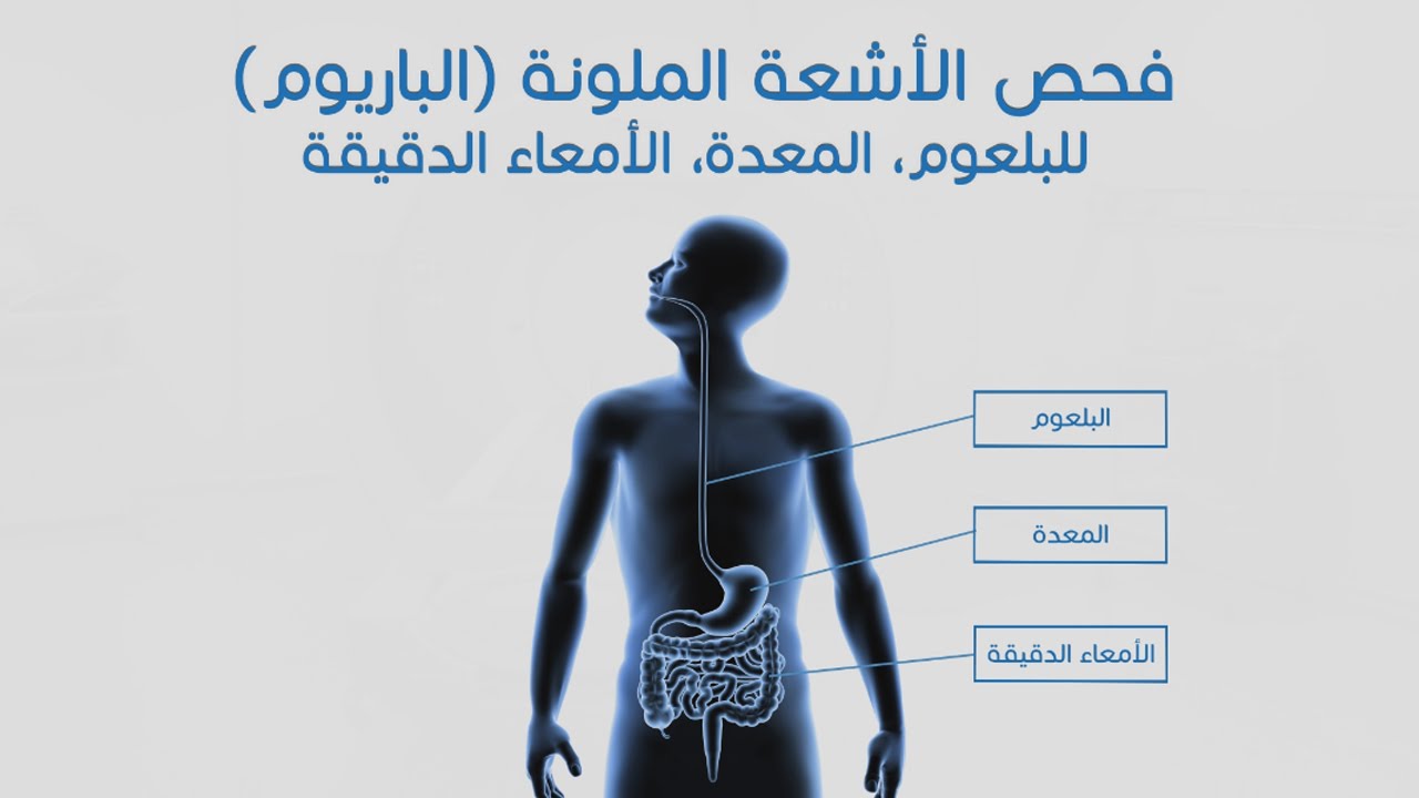 فحص الأشعة الملونة ( الباريوم ) للبلعوم - المعدة - الأمعاء الدقيقة