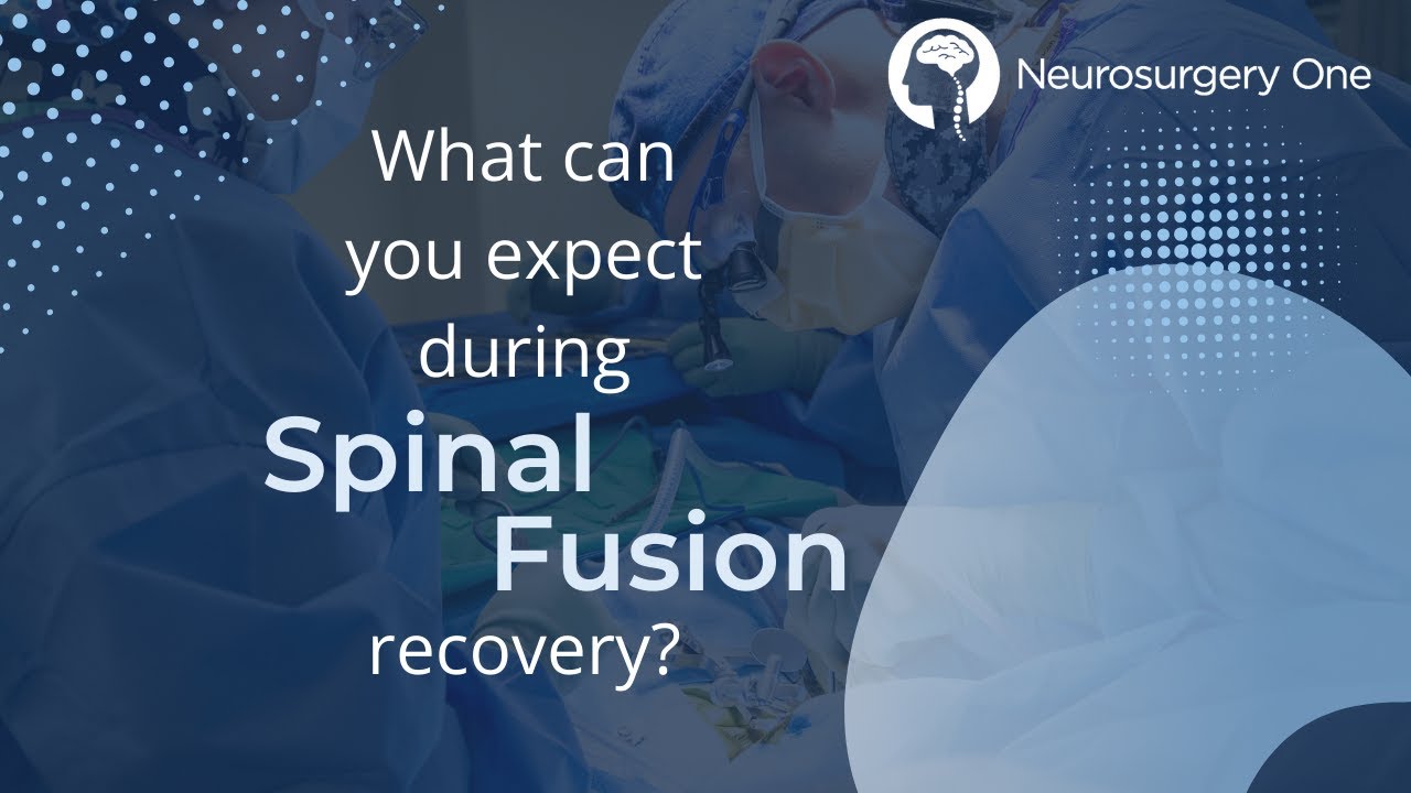 What can you expect during spinal fusion recovery?