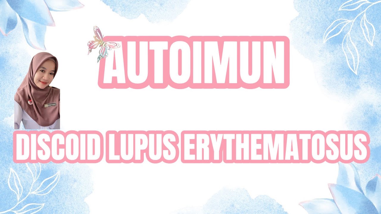 Aku di diagnosa AUTOIMUN DLE (DISCOID LUPUS ERYTHEMATOSUS)