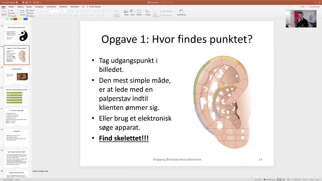 Øreakupunktur