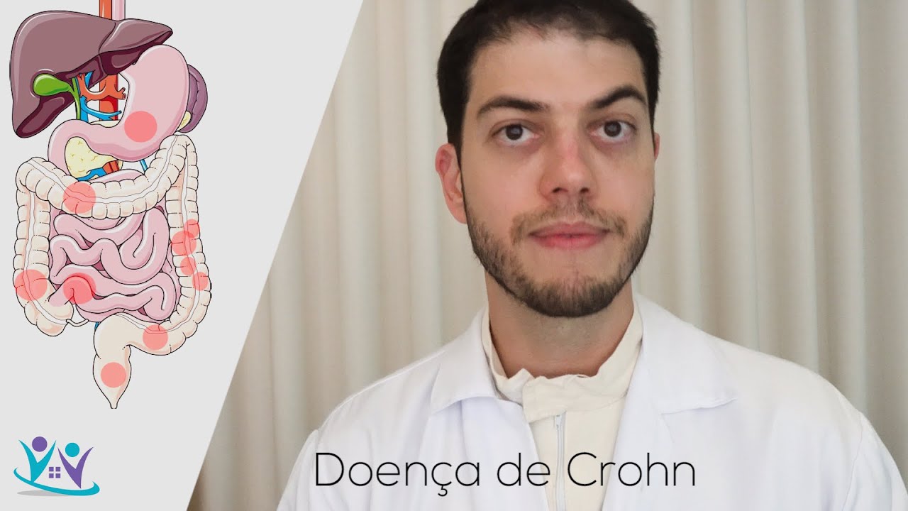 O que &eacute;? O que &eacute; doen&ccedil;a de Crohn?