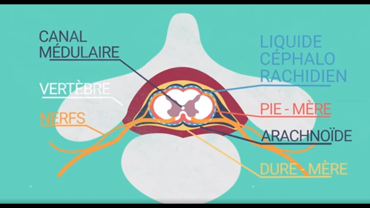DES MOTS DERRIERE NOS MAUX -  La syringomyélie post- traumatique