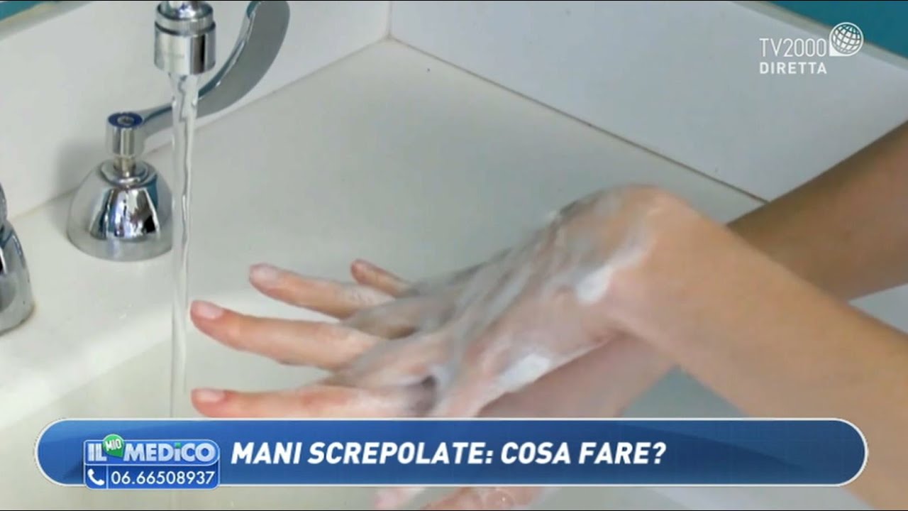 Il Mio Medico - Mani screpolate, cosa fare?