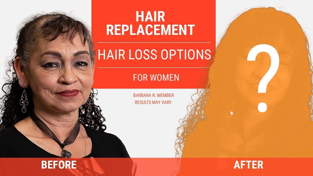 Can HairClub help women? | Female Hair Replacement Options