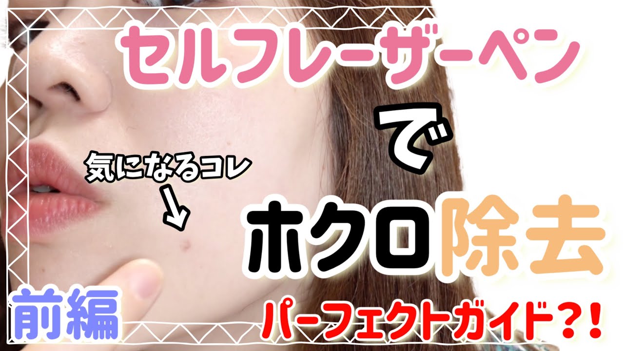 （検証）レーザーペンでホクロ取ってみた（前編）