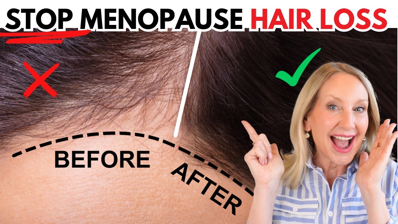 This WORKS to Prevent Hair Loss (Women Over 50)