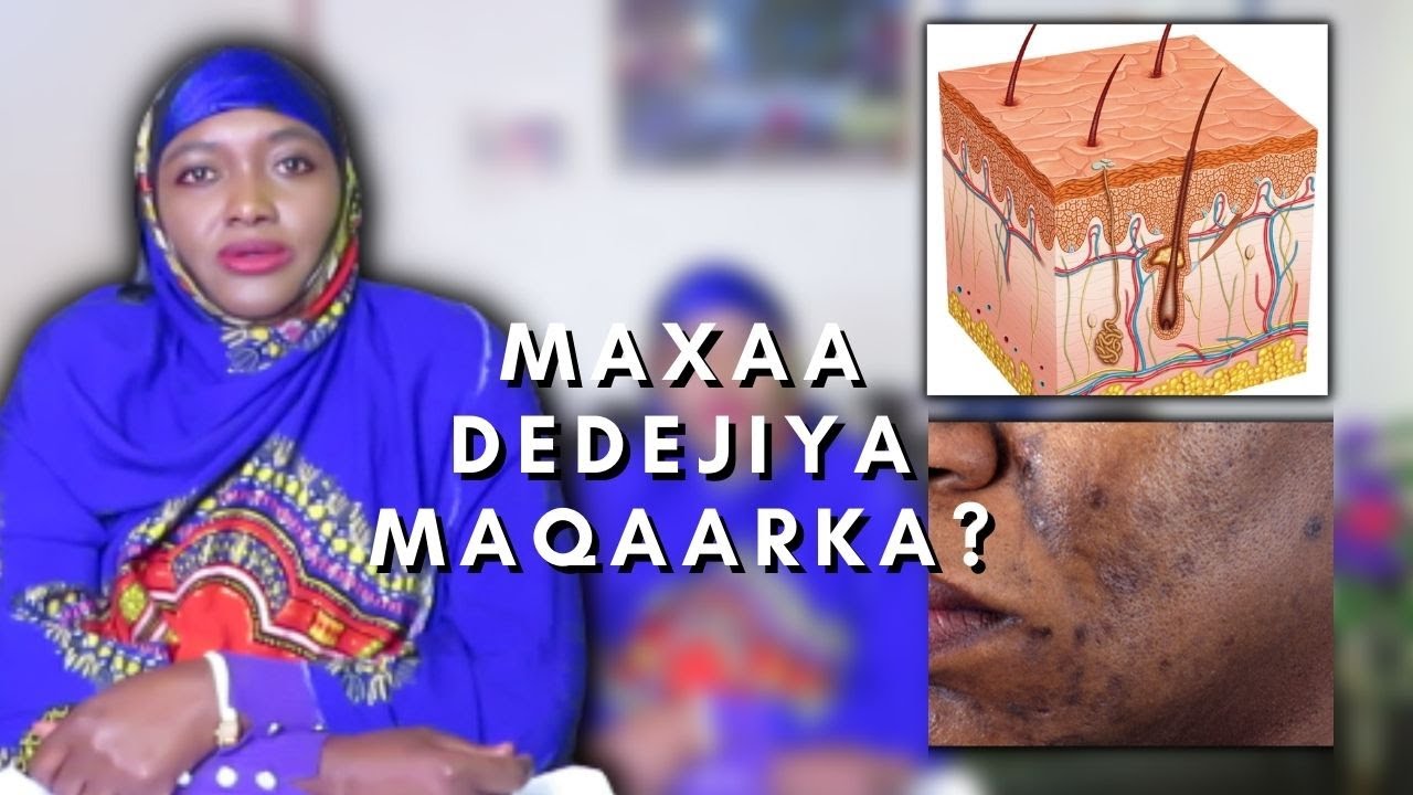 MAQAARKA MURUGTIISA MAANTA AYAAY KU DEEYSEY