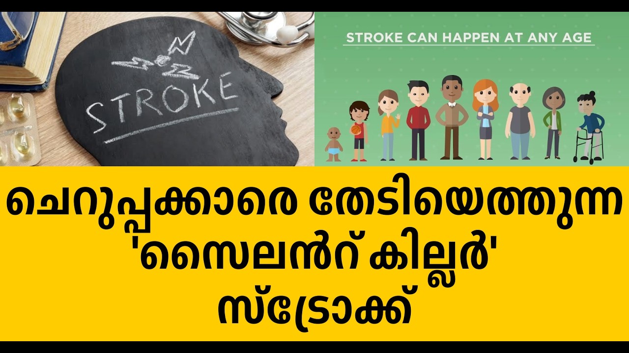 Stroke, the 'silent killer' that strikes young people! Don't ignore these five symptoms...
