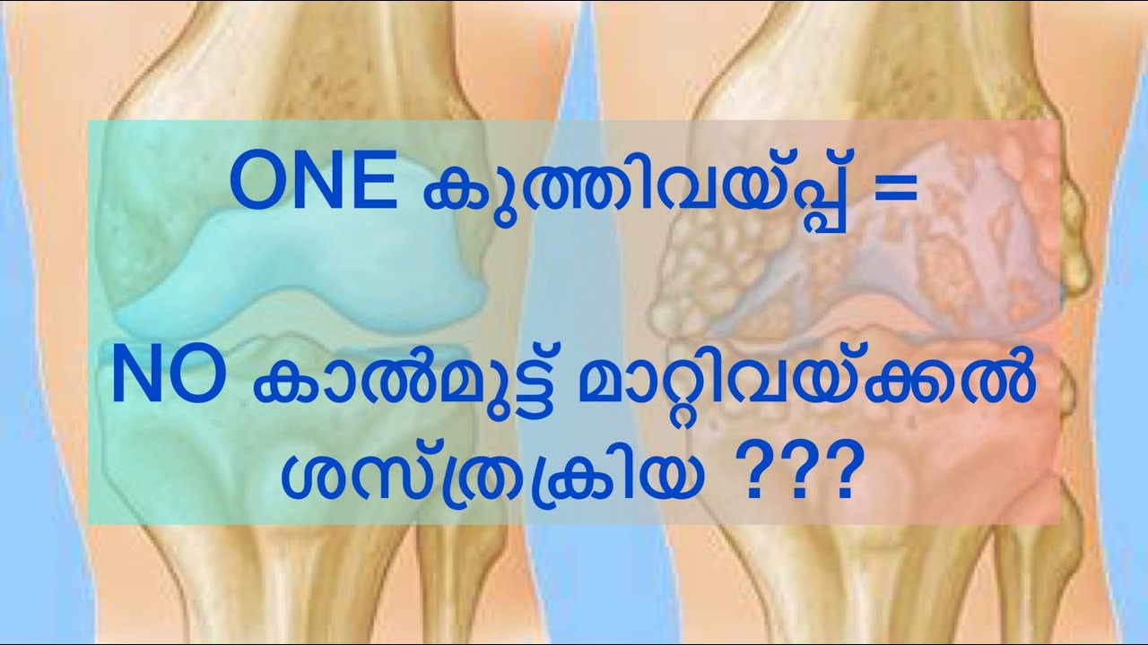 Regenerative therapy for knee pain