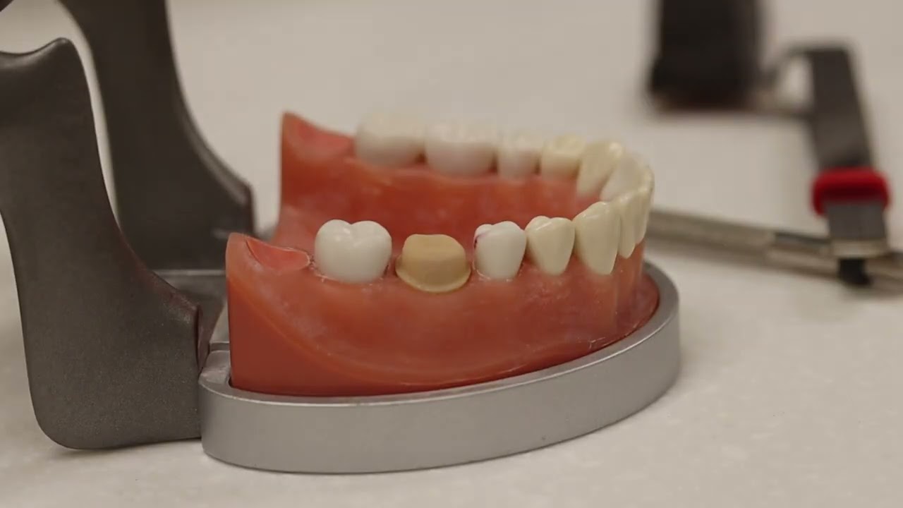 Zirconia Crown Chairside Adjustment and Polishing on a Typodont