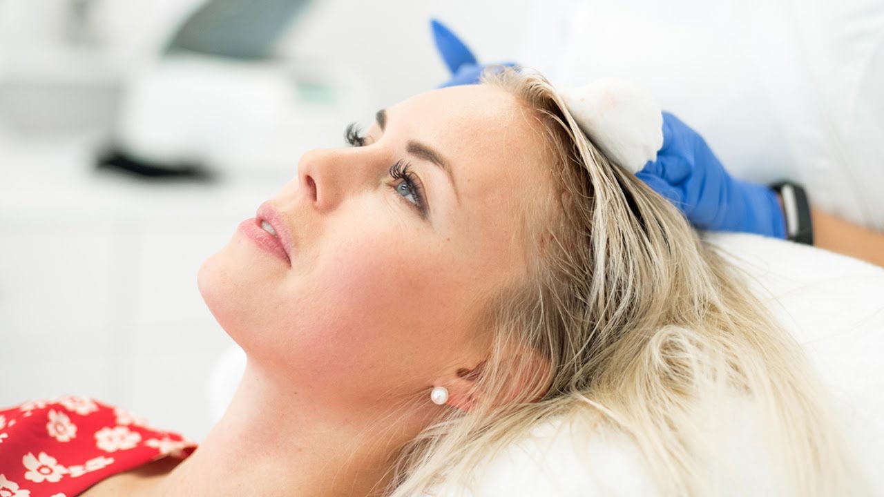 PRP-behandling för håret på Viktoria Maxe | Nordic Hair®