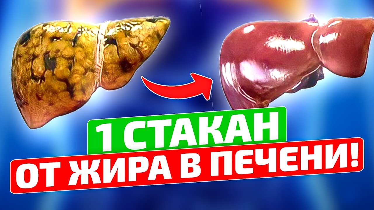 Пей залпом и печень, как в 20 лет! Как очистить печень от жира (жировой гепатоз печени)
