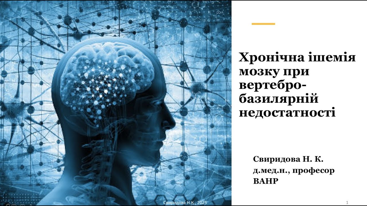Хронічна ішемія мозку при вертебро-базилярній недостатності