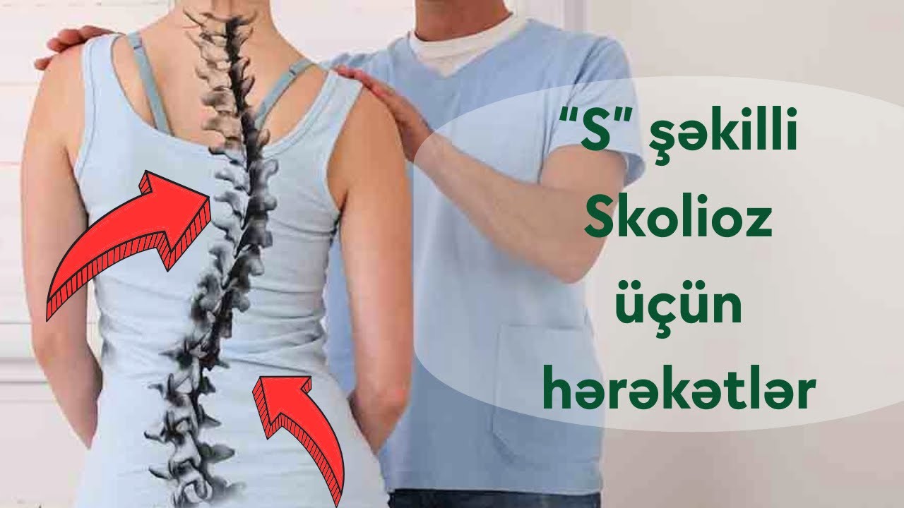 S ŞƏKİLLİ SKOLİOZ ÜÇÜN HƏRƏKƏTLƏR | FİZİOTERAPEVT AZİZ DAVRİSHOV