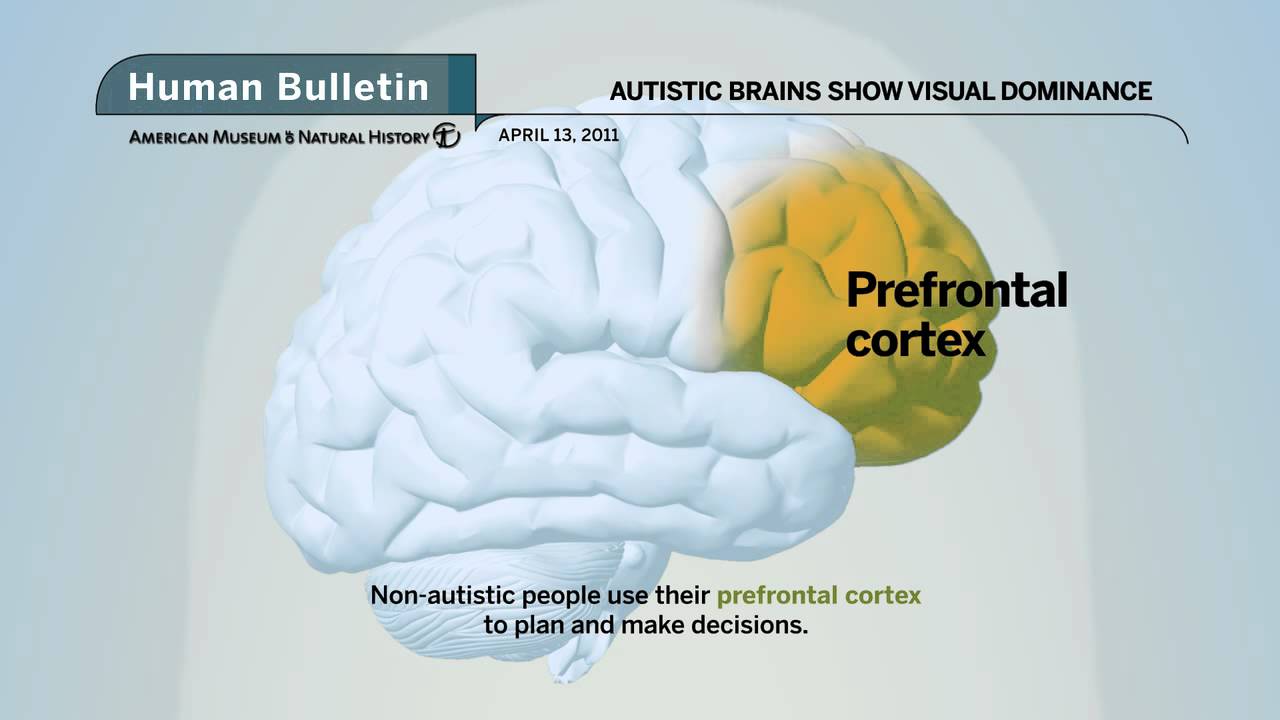 Science Bulletins: Autistic Brains Show Visual Dominance