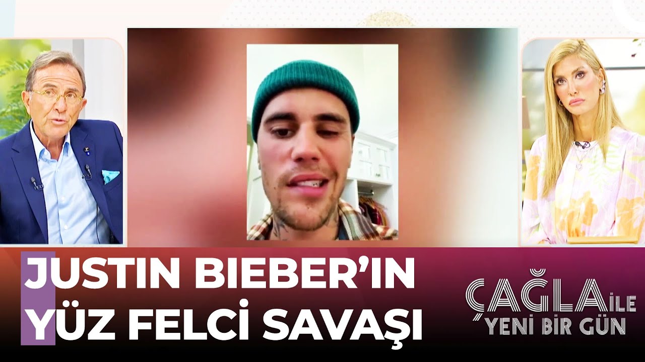 Justın Bieber Geçirdiği Yüz Felcini Anlatıyor - Çağla İle Yeni Bir Gün 870. Bölüm