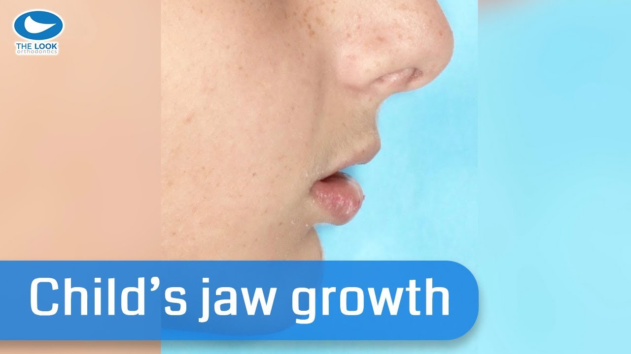 Will my child's jaw grow?