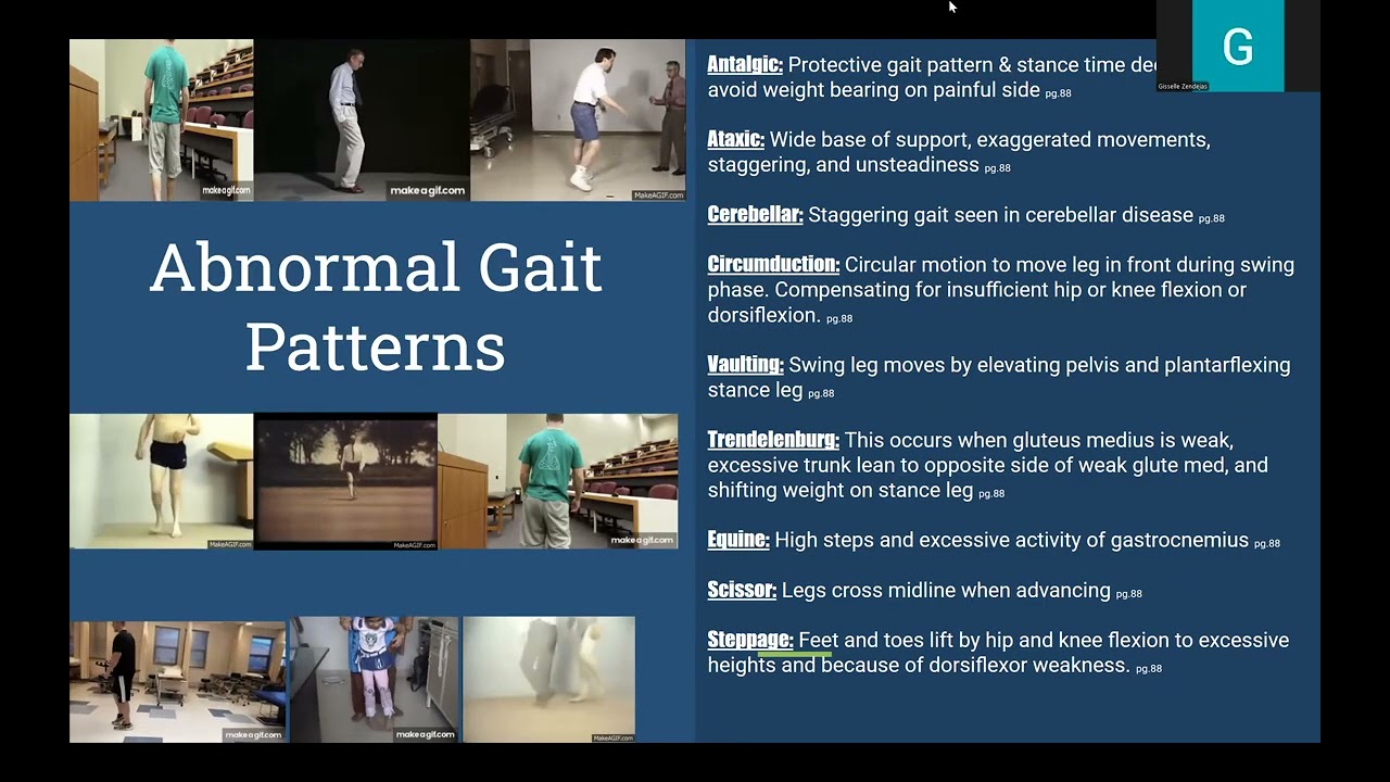 Week #2 Teach Back: Gait