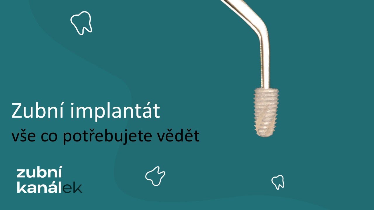 Zubní implantát - vše co potřebujete vědět