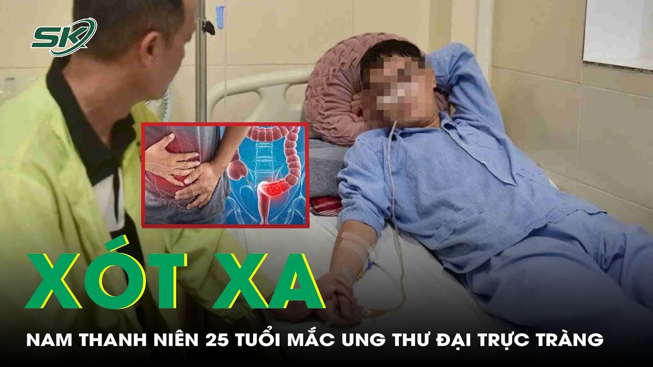 Xót xa: Nam thanh niên 25 tuổi mắc ung thư đại trực tràng vì thói quen phổ biến ở giới trẻ | SKĐS