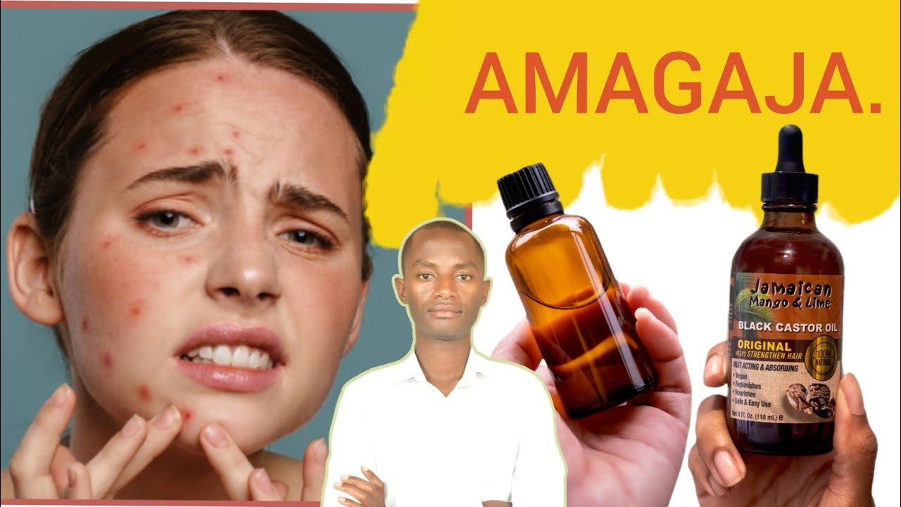 Amavuta avura indwara z'uruhu, iminkanyari, uruhara, imvuvu, umwijima. Umumaro w'amagaja/castor oil