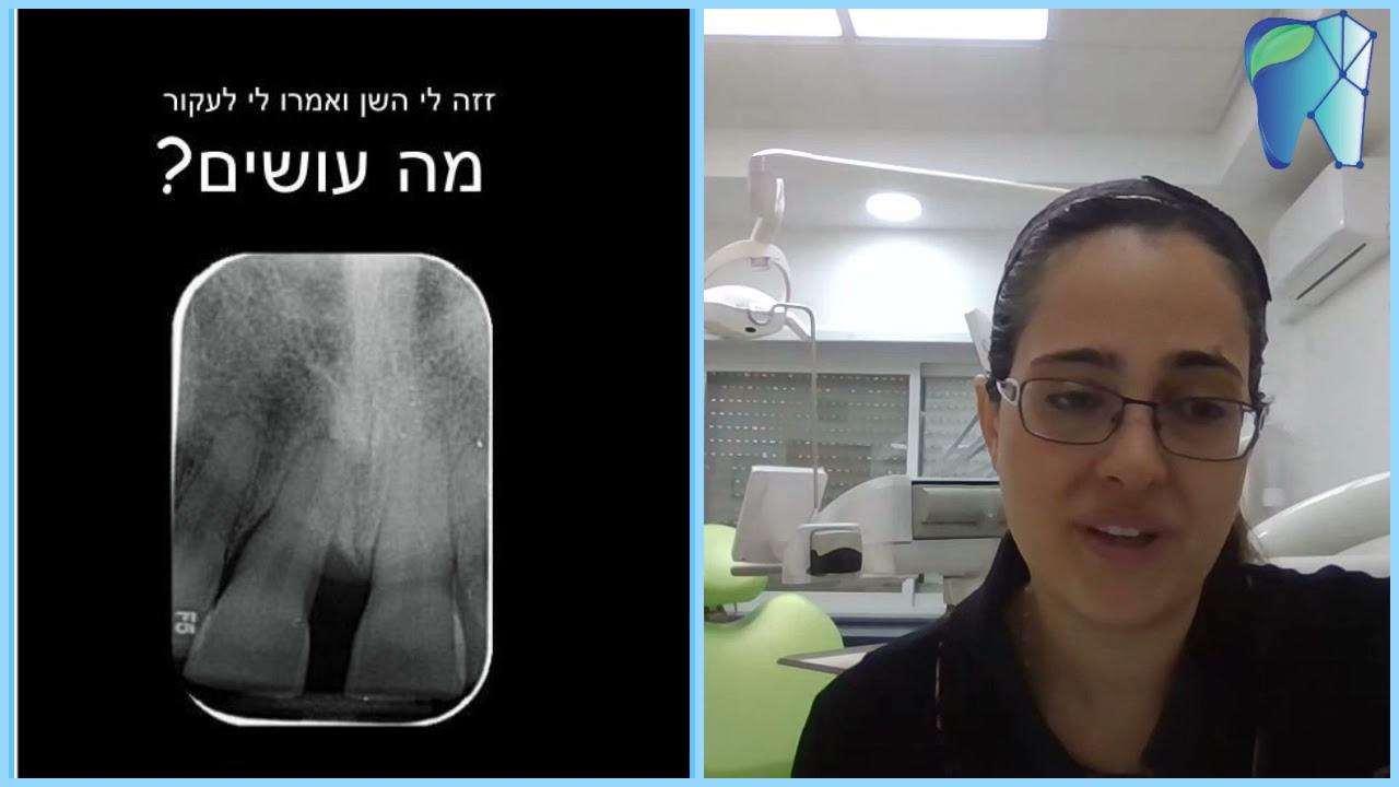 זזה לי השן ואמרו לי לעקור- מה עושים? צפו וגלו תשובה מד