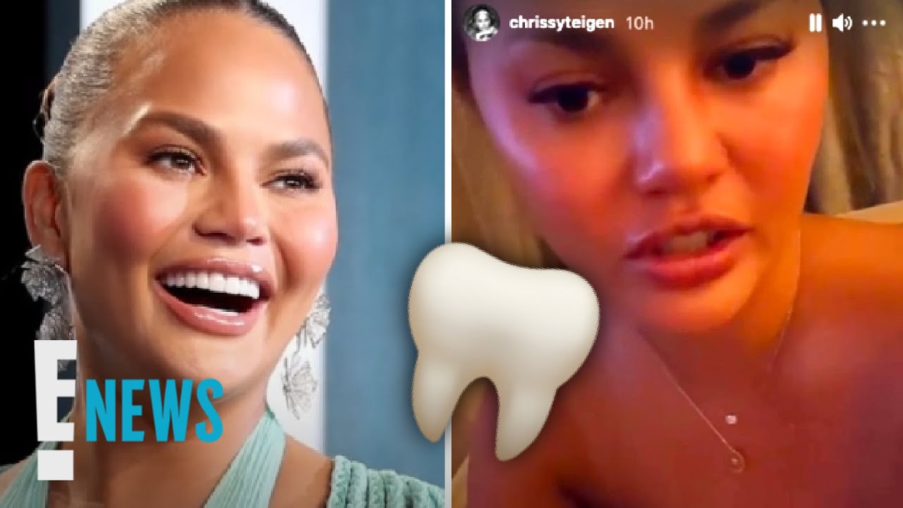 Chrissy Teigen Loses Her Tooth the Night of Biden's Inauguration | E! News