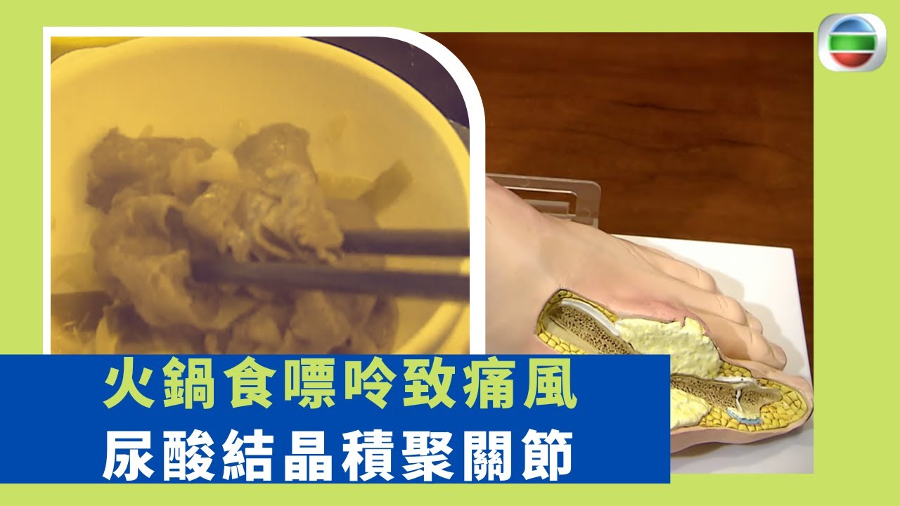 健康360 TVB｜火鍋食嘌呤致痛風 尿酸結晶積聚關節 患者天生排出尿酸能力較低  小兒手足口病預防 發燒持續手部紅疹 ｜最強生命線