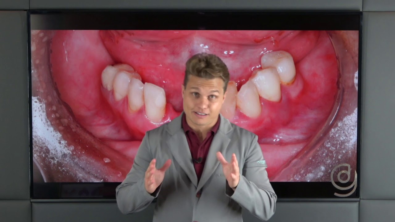 Protocolo sobre implantes
