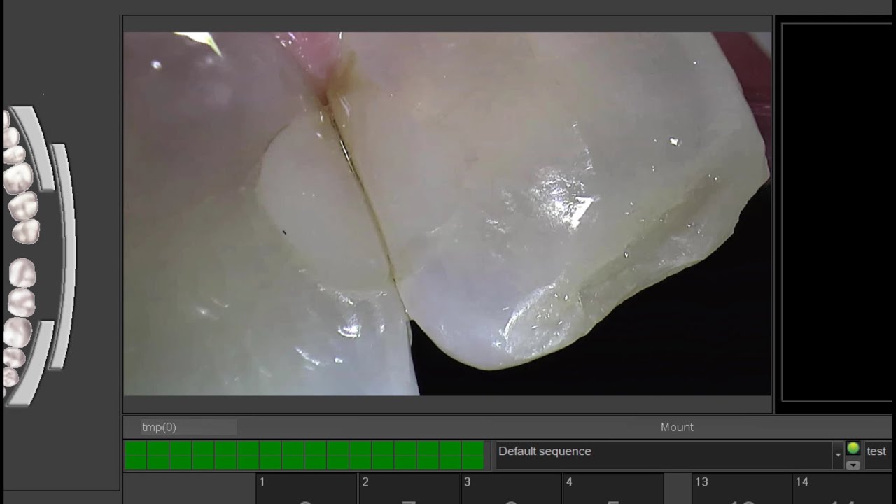 Image quality and auto-focus of the CADI Optiview 2 intra-oral camera