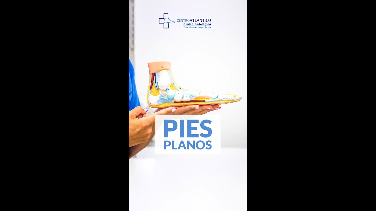 Pies planos en niños - Podología infantil - Centro Atlántico Pontevedra