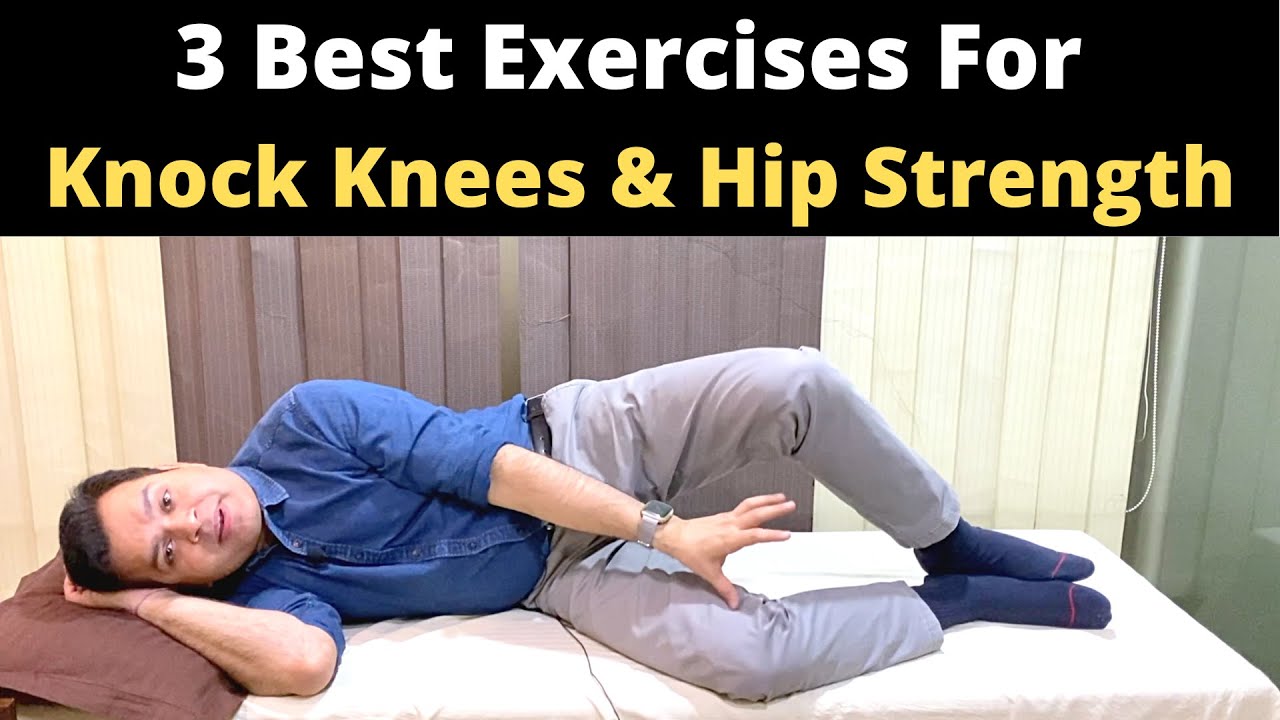 3 Best Exercises For Knock Knees, Hip strengthening Exercises For Knock Knees Treatment, Genu Valgum
