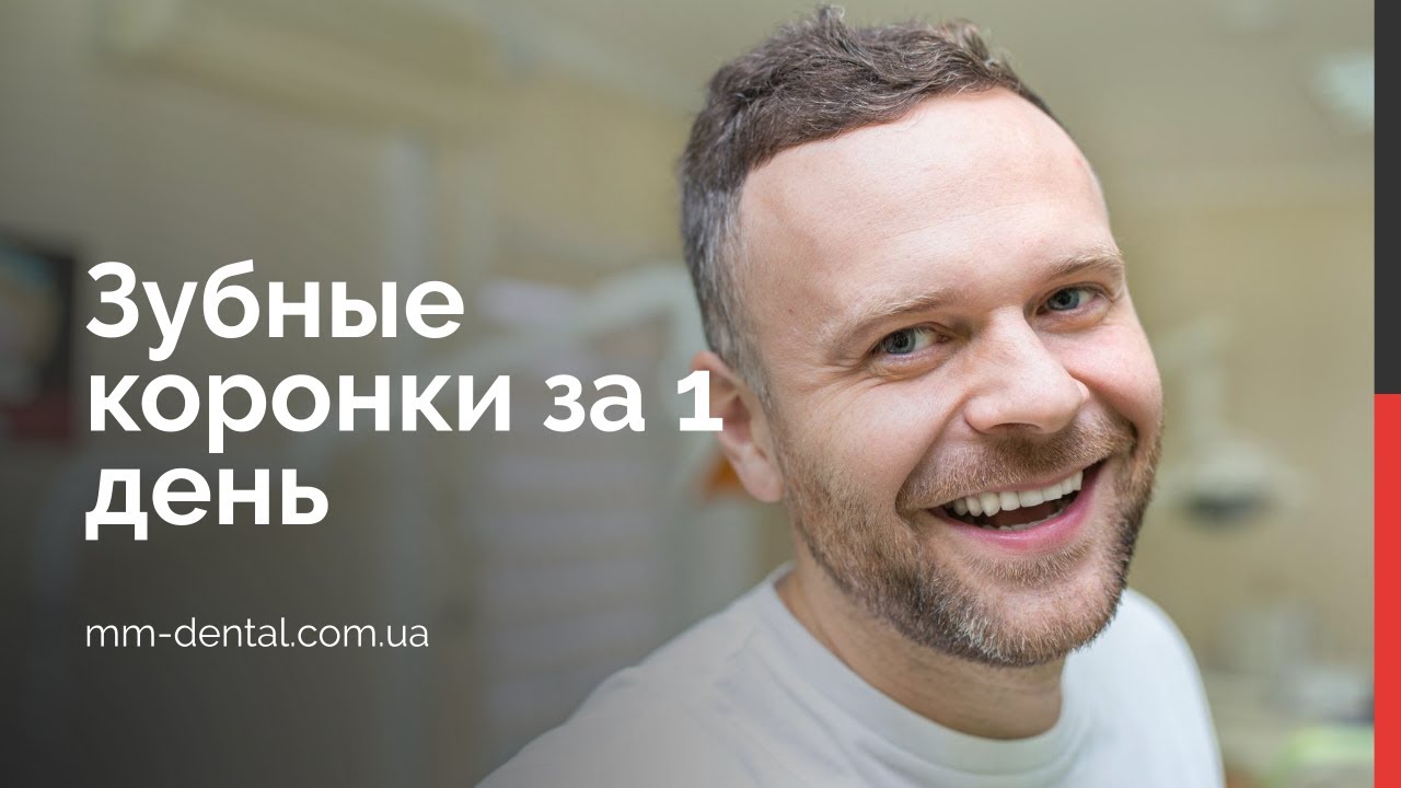 Новые зубы за 1 день 🇺🇦 зубные коронки за 1 посещение стоматологии
