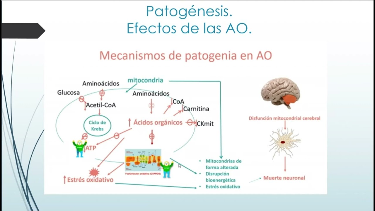 Acidemias Organicas Dr  G  Silva