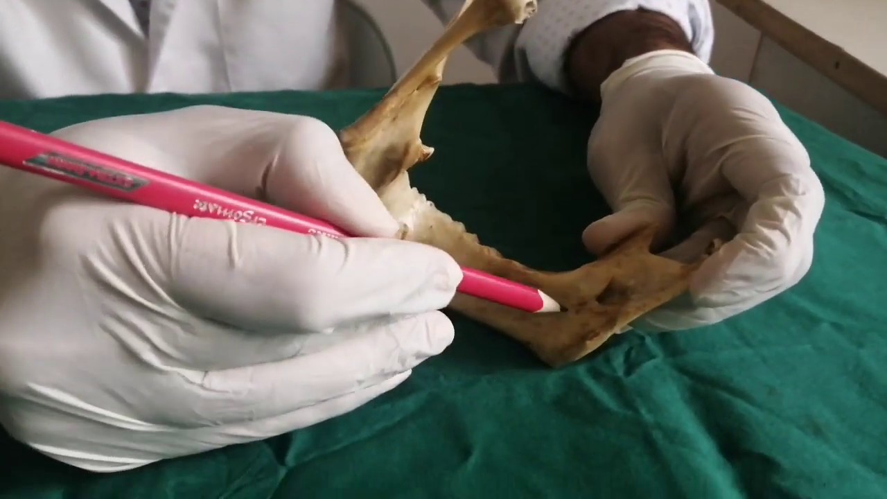 Anatomy and Demonstration of inferior alveolar nerve block - 3rd BDS class