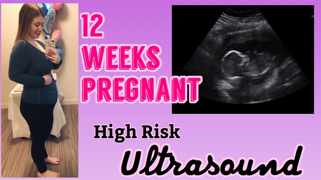 First High Risk Doctor Appointment - 12 weeks pregnant