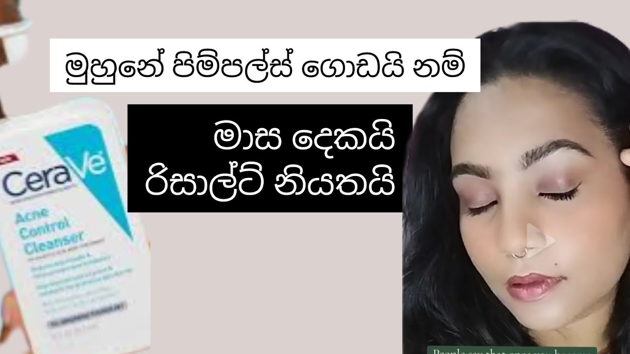 Cerave Acne Control Cleanser Sinhala Review #ceraveskincare #libertystore